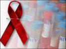 Apparent Immunity Gene ‘Cures’ Bay Area Man of AIDS